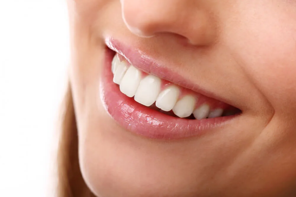 Blanqueamiento dental El Salvador
