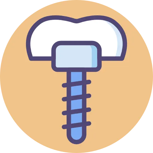 Implantes Dentales en El Salvador
